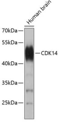 Western Blot: PFTK1 Antibody [NBP2-94848] - Analysis of extracts of human brain, using PFTK1 at 1:10000 dilution.Lysates/proteins: 25ug per lane.Blocking buffer: 3% nonfat dry milk in TBST.