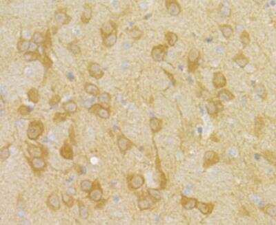 Immunohistochemistry: PGAM1 Antibody (JE40-67) [NBP2-76862] - Immunohistochemical analysis of paraffin-embedded rat brain tissue using anti-PGAM1 antibody. Counter stained with hematoxylin.