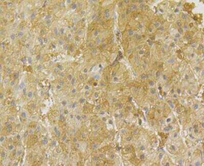 Immunohistochemistry: PGAM1 Antibody (JE40-67) [NBP2-76862] - Immunohistochemical analysis of paraffin-embedded human liver tissue using anti-PGAM1 antibody. Counter stained with hematoxylin.
