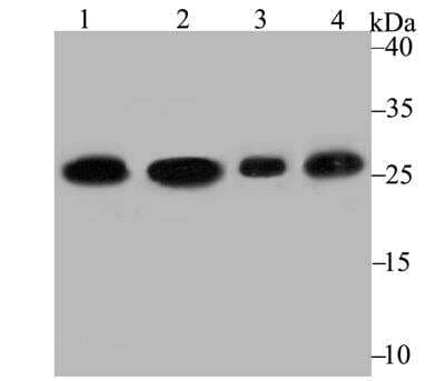 Western Blot: PGAM1 Antibody (JE40-67) [NBP2-76862] - Western blot analysis of PGAM1 on different lysates using anti-PGAM1 antibody at 1/2,000 dilution.Positive control:Lane 1: A431 Lane 2: A549Lane 3: Rat brain Lane 4: Mouse brain
