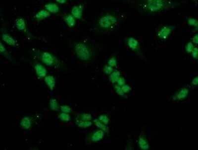 Immunocytochemistry/Immunofluorescence: PGAM2 Antibody (OTI4E9) - Azide and BSA Free [NBP2-73358] - Staining of HeLa cells using anti-PGAM2 mouse monoclonal antibody.
