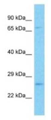 Western Blot: PGAM4 Antibody [NBP3-09875] - Western blot analysis of PGAM4 in 293T Whole Cell lysates. Antibody dilution at 1.0ug/ml