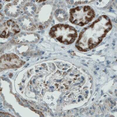 Immunohistochemistry-Paraffin: PGAM5 Antibody (CL0624) [NBP2-52947] - Staining of human kidney shows either strong or moderate cytoplasmic immunoreactivity in subsets of renal tubules.