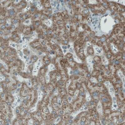 Immunohistochemistry-Paraffin: PGAM5 Antibody (CL0624) [NBP2-52947] - Staining of human liver shows moderate cytoplasmic immunoreactivity in hepatocytes.