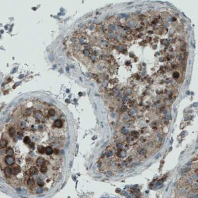 Immunohistochemistry-Paraffin: PGAM5 Antibody (CL0624) [NBP2-52947] - Staining of human testis shows moderate to strong cytoplasmic positivity in the seminiferous ducts.