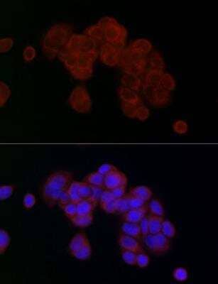 Immunocytochemistry/Immunofluorescence: PGAM5 Antibody [NBP2-93600] -  Analysis of MCF7 cells using PGAM5 Rabbit pAb at dilution of 1:25 (40x lens). Blue: DAPI for nuclear staining.