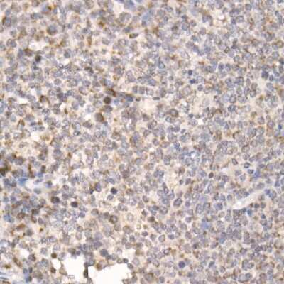 Immunohistochemistry-Paraffin: PGAM5 Antibody [NBP2-93600] - Human tonsil using PGAM5 Rabbit pAb (NBP2-93600) at dilution of 1:25 (40x lens). Perform high pressure antigen retrieval with 10 mM citrate buffer pH 6.0 before commencing with IHC staining protocol.