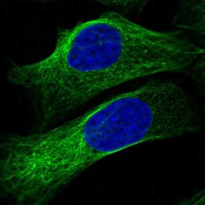 Immunocytochemistry/ Immunofluorescence PGAP2 Antibody