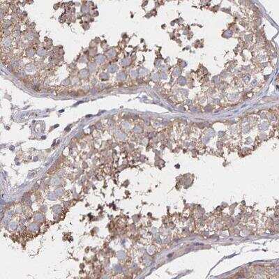 Immunohistochemistry-Paraffin PGAP2 Antibody