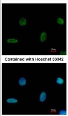 Immunocytochemistry/ Immunofluorescence PGBD1 Antibody