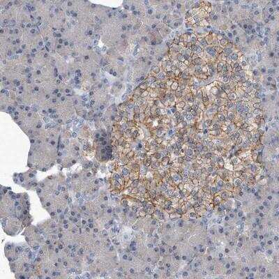 Immunohistochemistry: PGBD2 Antibody [NBP1-86348] - Staining of human pancreas shows moderate membranous positivity in islet cells.