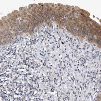Immunohistochemistry-Paraffin: PGBD2 Antibody [NBP1-85936] - Staining of human urinary bladder shows moderate cytoplasmic positivity in urothelial cells.