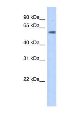 Western Blot: PGBD3 Antibody [NBP1-57117] - Transfected 293T cell lysate, concentration 0.2-1 ug/ml.
