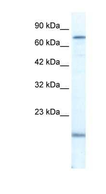 Western Blot: PGBD3 Antibody [NBP1-57283] - Jurkat cell lysate, concentration 2.5 ug/ml.
