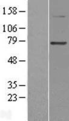Western Blot: PGBD3 Overexpression Lysate (Adult Normal) [NBL1-14326] Left-Empty vector transfected control cell lysate (HEK293 cell lysate); Right -Over-expression Lysate for PGBD3.