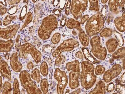 Immunohistochemistry-Paraffin PGBD4 Antibody - BSA Free