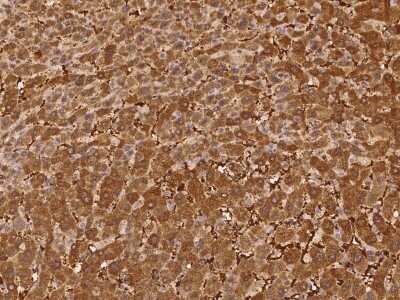 Immunohistochemistry-Paraffin PGBD4 Antibody - BSA Free