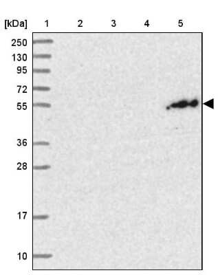 Western Blot: PGBD4 Antibody [NBP1-81995] - Lane 1: Marker  [kDa] 250, 130, 95, 72, 55, 36, 28, 17, 10.  Lane 2: Human cell line RT-4.  Lane 3: Human cell line U-251MG sp.  Lane 4: Human plasma (IgG/HSA depleted).  Lane 5: Human liver tissue
