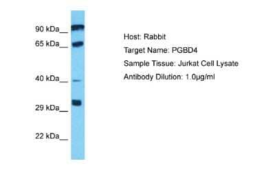 Western Blot: PGBD4 Antibody [NBP2-85466] - Host: Rabbit. Target Name: PGBD4. Sample Type: Jurkat Whole Cell lysates. Antibody Dilution: 1.0ug/ml
