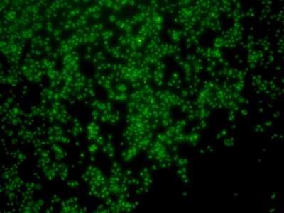 Immunocytochemistry/Immunofluorescence: PGBD5 Antibody (7-F8-5) [NBP2-67048] - Staining of F9 cells using anti-PGBD5 Mouse mAb.