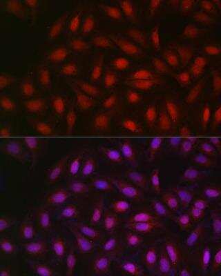 Immunocytochemistry/Immunofluorescence: PGC1 alpha Antibody [NBP3-08971] - Analysis of U2OS cells using PGC1 alpha Rabbit pAb at dilution of 1:50 (40x lens). Blue: DAPI for nuclear staining.