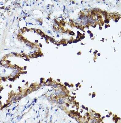 Immunohistochemistry-Paraffin: PGC1 alpha Antibody [NBP3-08971] - Rat lung using PGC1 alpha Rabbit pAb at dilution of 1:50 (40x lens).Perform high pressure antigen retrieval with 10 mM citrate buffer pH 6.0 before commencing with IHC staining protocol.
