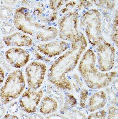Immunohistochemistry-Paraffin: PGC1 alpha Antibody [NBP3-08971] - Mouse kidney using PGC1 alpha Rabbit pAb at dilution of 1:50 (40x lens).Perform high pressure antigen retrieval with 10 mM citrate buffer pH 6.0 before commencing with IHC staining protocol.