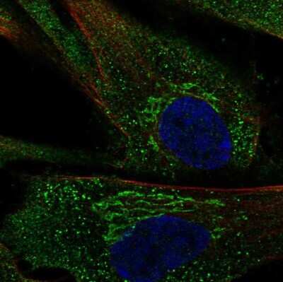 <b>Orthogonal Strategies Validation. </b>Immunocytochemistry/Immunofluorescence: PGCP Antibody [NBP1-87457] - Staining of human cell line ASC TERT1 shows localization to the Golgi apparatus & vesicles. Antibody staining is shown in green.