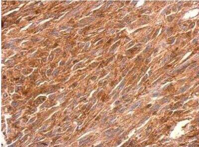 Immunohistochemistry-Paraffin: PGCP Antibody [NBP1-32328] - U373 xenograft. PGCP antibody dilution: 1:500. Antigen Retrieval: Trilogy™ (EDTA based, pH 8.0) buffer, 15min. 