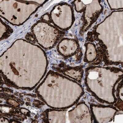 Immunohistochemistry-Paraffin: PGCP Antibody [NBP1-87457] - Staining of human thyroid gland shows high expression.
