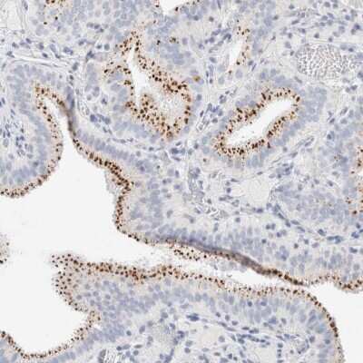 Immunohistochemistry-Paraffin: PGCP Antibody [NBP1-87545] - Staining of human gallbladder shows cytoplasmic positivity in glandular cells.