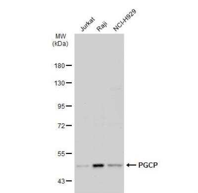 Western Blot: PGCP Antibody [NBP1-32328] - Various whole cell extracts (30 ug) were separated by 7.5% SDS-PAGE, and the membrane was blotted with PGCP antibody diluted at 1:500. The HRP-conjugated anti-rabbit IgG antibody (NBP2-19301) was used to detect the primary antibody.