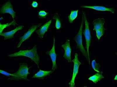 Immunocytochemistry/Immunofluorescence: PGD Antibody [NBP2-99282] - Immunofluorescence staining of PGD in Hela cells. Cells were fixed with 4% PFA, permeabilzed with 0.3% Triton X-100 in PBS, blocked with 10% serum, and incubated with rabbit anti-human PGD polyclonal antibody (1:1000) at 4C overnight. Then cells were stained with the Alexa Fluor(R)488-conjugated Goat Anti-rabbit IgG secondary antibody (green) and counterstained with DAPI (blue). Positive staining was localized to cytoplasm.