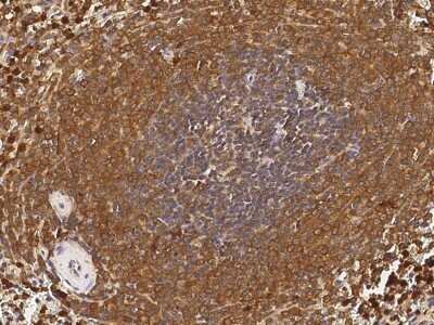 Immunohistochemistry-Paraffin: PGD Antibody [NBP2-99282] - Immunochemical staining of human PGD in human spleen with rabbit polyclonal antibody (1:5000, formalin-fixed paraffin embedded sections).