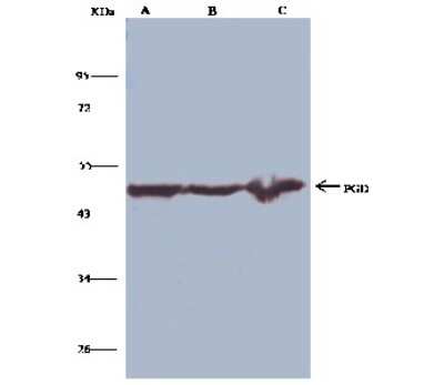 Immunoprecipitation: PGD Antibody [NBP2-99282] - PGD was immunoprecipitated using: Lane A: 0.5 mg Raji Whole Cell Lysate. Lane B: 0.5 mg MOLT-4 Whole Cell Lysate. Lane C: 0.5 mg A549 Whole Cell Lysate4 ul anti-PGD rabbit polyclonal antibody and 15 ul of 50 % Protein G agarose. Primary antibody: Anti-PGD rabbit polyclonal antibody, at 1:100 dilution. Secondary antibody: Clean-Bloto IP Detection Reagent (HRP) at 1:1000 dilution. Developed using the DAB staining technique. Performed under reducing conditions. Predicted band size: 53 kDa. Observed band size: 53 kDa