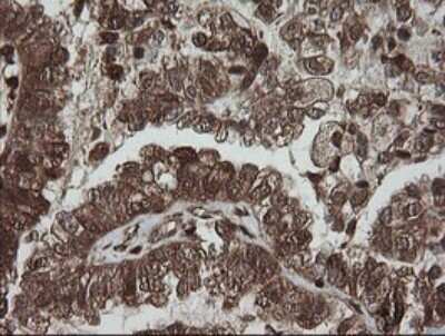 Immunohistochemistry: PGD Antibody (OTI2A5) - Azide and BSA Free [NBP2-73361] - Human ovary tissue using anti-PGD mouse monoclonal antibody. (Heat-induced epitope retrieval by 10mM citric buffer, pH6.0, 100 degrees C for 10min.