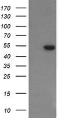 Western Blot: PGD Antibody (OTI2A5) - Azide and BSA Free [NBP2-73361] - Analysis of HEK293T cells were transfected with the pCMV6-ENTRY control (Left lane) or pCMV6-ENTRY PGD.