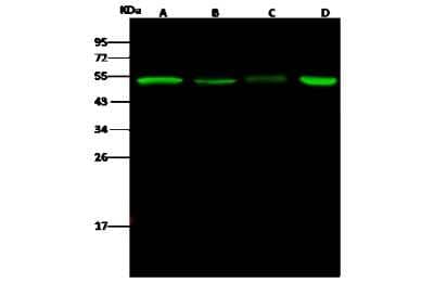 Western Blot: PGD Antibody [NBP2-99282] - Anti-PGD rabbit polyclonal antibody at 1:500 dilution. Lane A: Raji Whole Cell Lysate. Lane B: MCF7 Whole Cell Lysate. Lane C: Mouse spleen tissue lysate Lane D: A549 Whole Cell Lysate. Lysates/proteins at 30 ug per lane. Secondary Goat Anti- Rabbit IgG H&L (Dylight 800) at 1/10000 dilution. Developed using the Odyssey technique. Performed under reducing conditions. Predicted band size: 53 kDa. Observed band size: 53 kDa