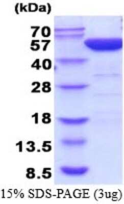 SDS-Page: Recombinant Human PGD Protein [NBP2-52238] - 15% SDS Page (3 ug)