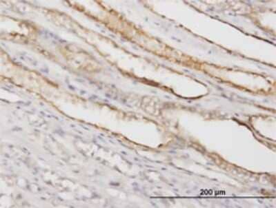 Immunohistochemistry-Paraffin: PGGT1B Antibody (5E4) [H00005229-M02] - Analysis of monoclonal antibody to PGGT1B on formalin-fixed paraffin-embedded human kidney. Antibody concentration 1.2 ug/ml.