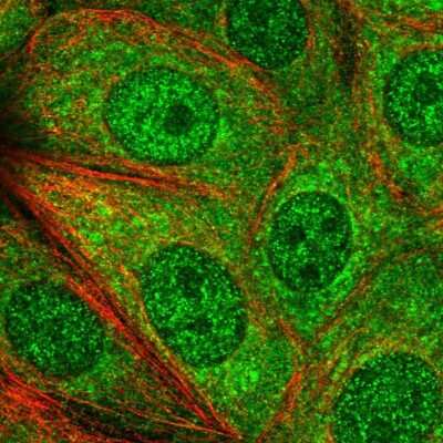 Immunocytochemistry/Immunofluorescence: PGGT1B Antibody [NBP1-88643] - Staining of human cell line MCF7 shows positivity in cytoplasm & nucleus but excluded from the nucleoli.