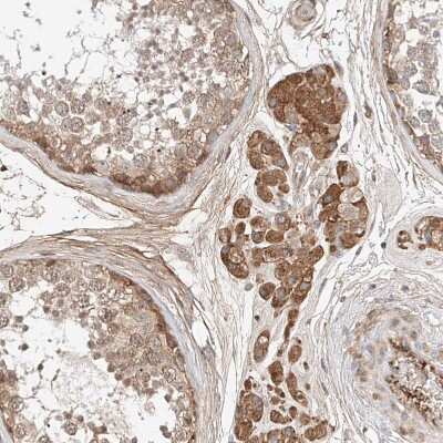 Immunohistochemistry-Paraffin: PGGT1B Antibody [NBP1-88643] - Staining of human testis shows moderate cytoplasmic positivity in Leydig cells.