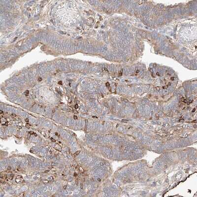 Immunohistochemistry-Paraffin: PGGT1B Antibody [NBP1-88643] - Staining of human Fallopian tube shows strong cytoplasmic positivity in stromal cells.