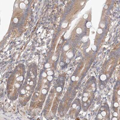 Immunohistochemistry-Paraffin: PGGT1B Antibody [NBP1-88643] - Staining of human duodenum shows moderate tcytoplasmic positivity in glandular cells.