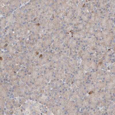 Immunohistochemistry-Paraffin: PGGT1B Antibody [NBP1-88643] - Staining of human pancreas shows weak cytoplasmic positivity in exocrine glandular cells.