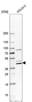 Western Blot: PGGT1B Antibody [NBP1-88643] - Analysis in human cell line HDLM-2.