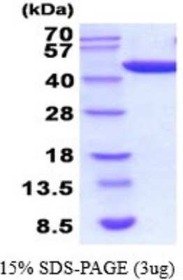 SDS-Page: Recombinant Human PGK1 Protein [NBP2-52249] - 15% SDS Page (3 ug)