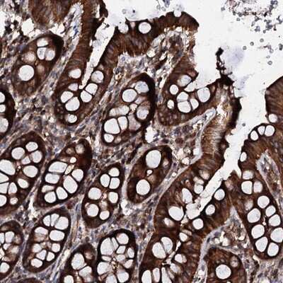 Immunohistochemistry-Paraffin: PGL2 Antibody [NBP1-92260] - Staining of human colon shows strong cytoplasmic positivity in glandular cells.