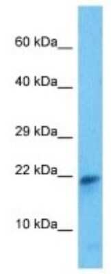 Western Blot: PGL2 Antibody [NBP3-10124] - Western blot analysis of PGL2 in Mouse SP2/0 Whole Cell lysates. Antibody dilution at 1ug/ml