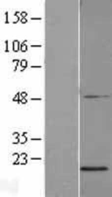 Western Blot: PGL2 Overexpression Lysate (Adult Normal) [NBL1-08123] Left-Empty vector transfected control cell lysate (HEK293 cell lysate); Right -Over-expression Lysate for PGL2.